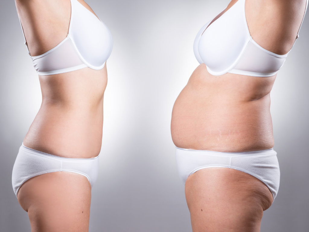 Fat Dissolving Injections