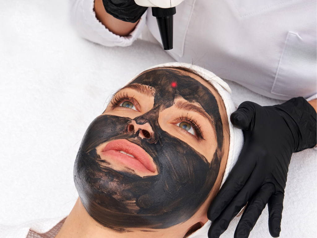 Carbon Laser Facial