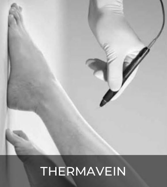 Thermavein Thermavein